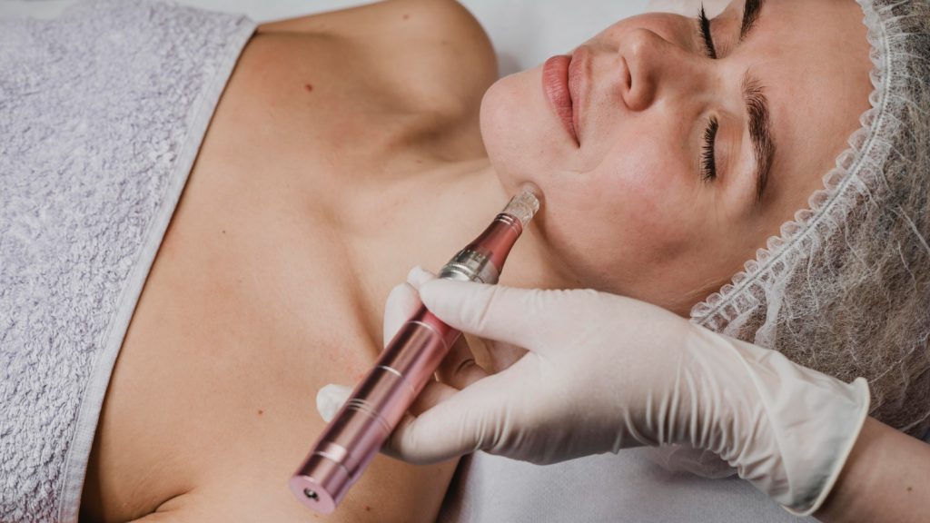 Skin Needling Services at MP Skin Check