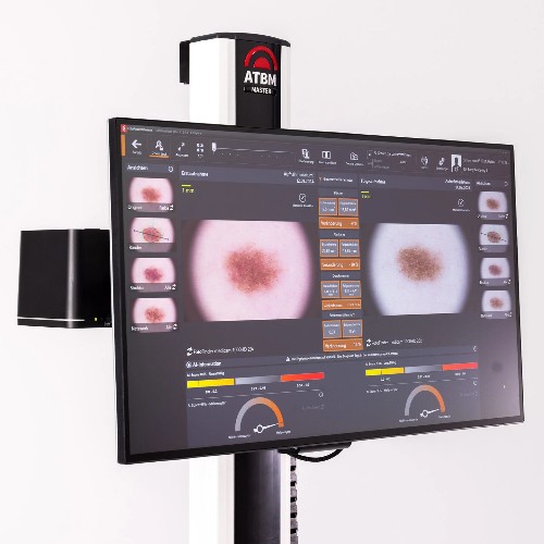 total body photography computer monitor