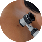 Skin analysis 300